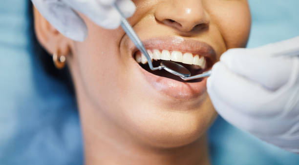 Best Emergency Denture Repair in West Ocean City, MD