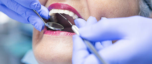 Best Emergency Dental Care for Broken or Chipped Teeth in West Ocean City, MD